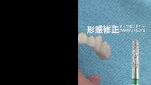 マイジンガー形態修正・研磨テクニック ジルコニアブリッジ