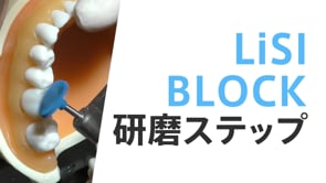 「イニシャル LiSiブロック」 インレー研磨ステップ（CA）
