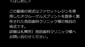 ファセットレジン 臨床動画