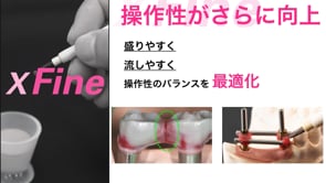 1分でわかるパターンレジンXF