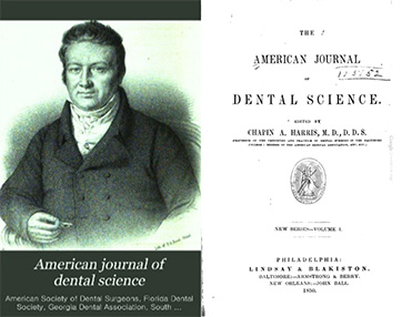 歯のホワイトニング治療について書かれた最も古い文献（1850年）