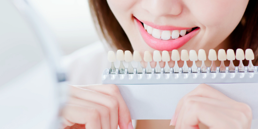 医療ホワイトニングの種類